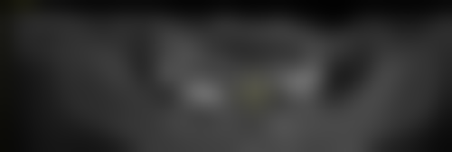 临沂锦涛口腔门诊部顾客实例有哪些