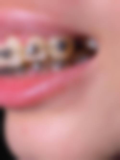 贵州贵美口腔诊所怎么样——患者评价