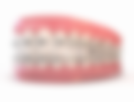 全口种植牙的优点是什么——舒适度高：仿若真牙无负担