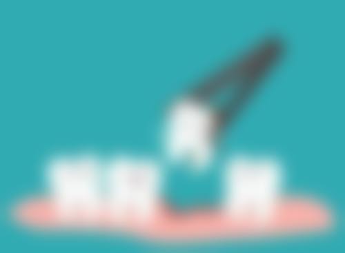 55岁能做种植牙吗？了解详细流程特别关键