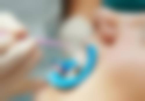 种植牙美国皓圣的牙好不好——价格揭秘性价比之选