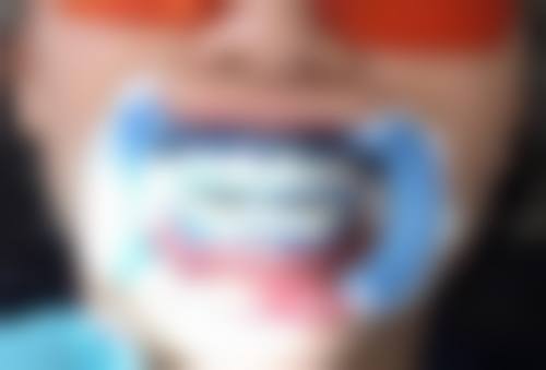 曾月医生口碑如何