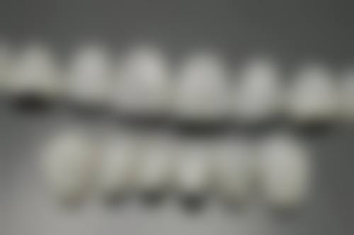 影响种植时机的三大关键因素