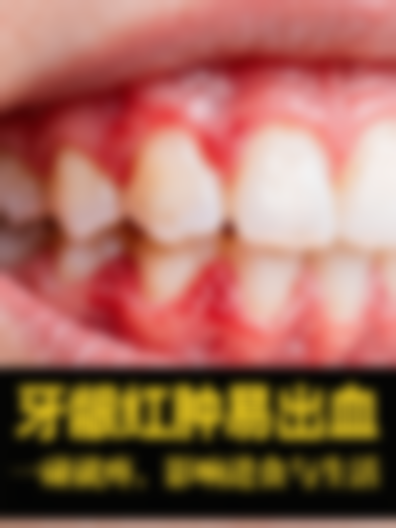 种植牙跟镶牙哪个好点——耐用度大比拼：谁能陪伴更长久？