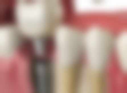 江苏宿迁沭阳县博凡口腔的抖音团购活动及价格表