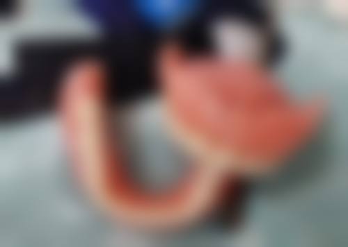 修复期注意事项：让“新骨头”快快长