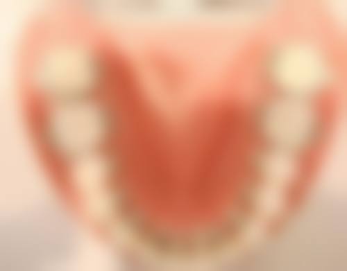 种植牙选韩国的怎么样——售后保护:贴心服务有保护