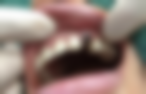 达州市文华绮云口腔门诊部顾客实例