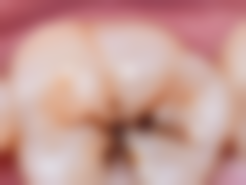 种植牙韩国和意大利使用寿命谁更长久