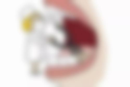 拔牙多久之后可以种植牙：如何判断自己可以种植了？