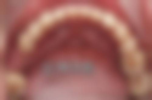 八、天津市口腔医院口腔颌面外科（正颌外科）价格表