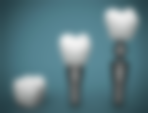 60岁还能种植牙齿吗之身体健康指标：身体“施工”条件要达标