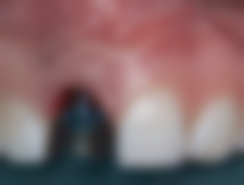 晋江牙乐口腔怎么样，口碑好不好