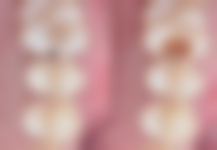 吴薇医生顾客实例图片