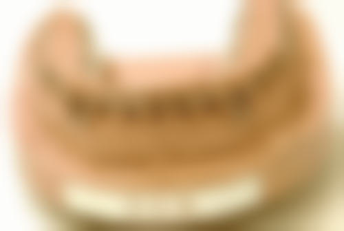 单颗种植牙植体选择：更省心的解决方案