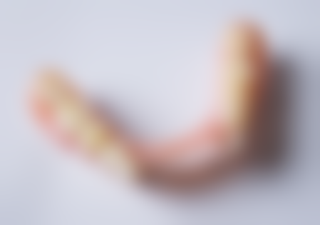 私立医院 vs 国有三等甲：种植牙植体选择差异分析