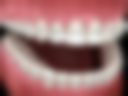 洛川县王玉娟口腔诊所价格表