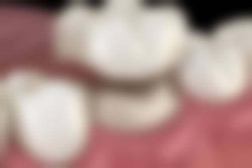 王呈祥医生简介做手术价格