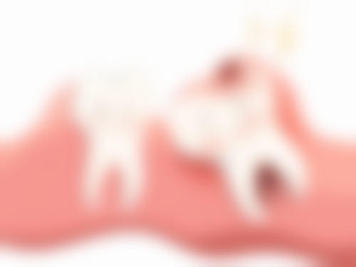 拔牙后即刻种植牙多长时间及适合人群分析