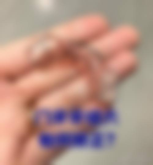 周修子医生简介项目优势