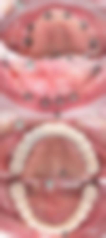 乌鲁木齐张一鹏口腔诊所怎么样,评价