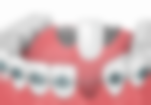 曾月医生口碑如何