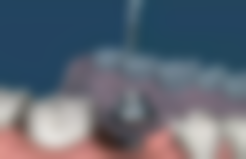 荀建东医生口碑如何