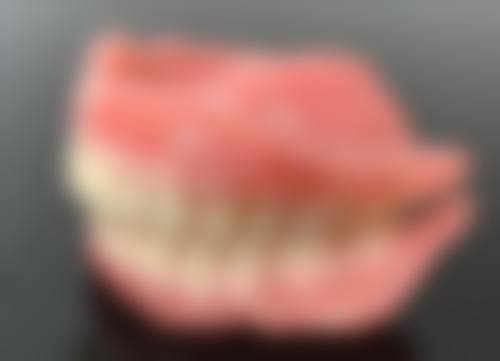 拔牙多久可以满口种植牙：即刻种植，当天种牙可能吗？