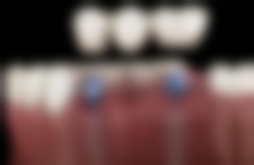 济南莱芜合美口腔口碑评价