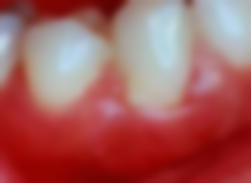 杨熙善医生顾客实例图片