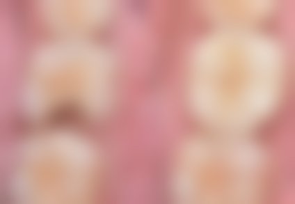 半口种植牙用全瓷牙冠的显著优势