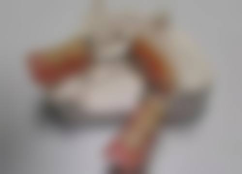 种植牙哪种品牌更好?——高端之选瑞士 ITI 种植系统的出色优势