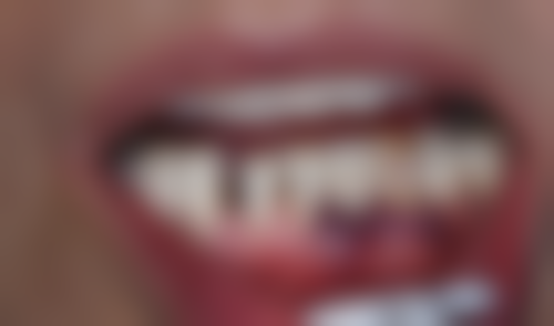 山西运城永济德恩牙科医生简介