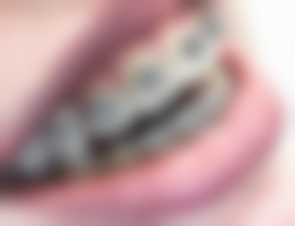 湖南长沙湘龙郭晶晶口腔正规吗