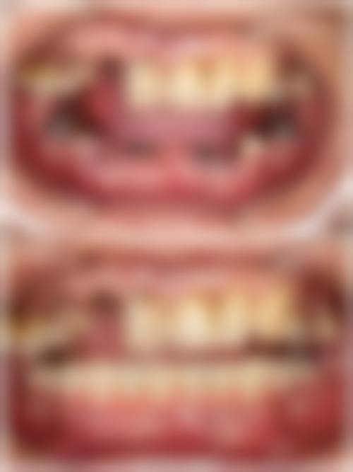 刘昌玲医生手术价格