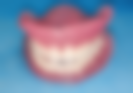 拔牙好几年了种植牙齿的成功几率：医院为你分析成功概率