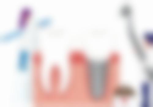 榆林艾尚雅口腔诊所怎么样,价格表