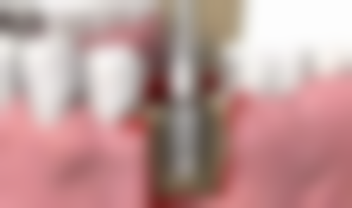 2026贵阳柏德口腔医院（云岩院区）任义收费标准——贵阳豪凌口腔诊所