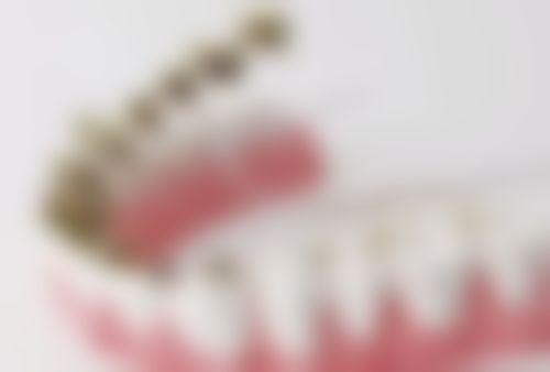 哪些口腔局部有炎症的老年人不能种植牙