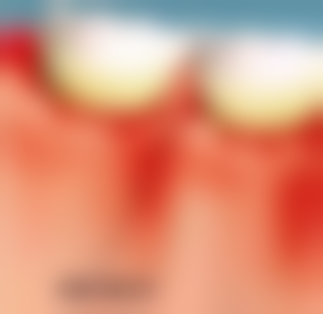 结语：守护牙齿健康，绽放自信笑容