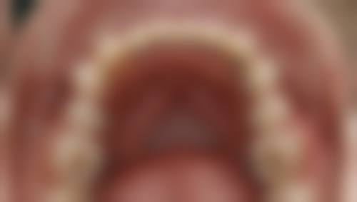 濮阳益康口腔诊所怎么样，更擅长什么