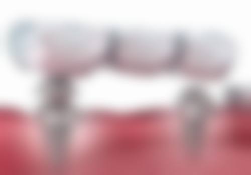 辽宁盘锦大众口腔门诊部怎么样？更擅长什么