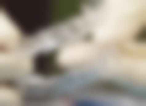 瑞士ITI种植牙操作简便成效怎么样