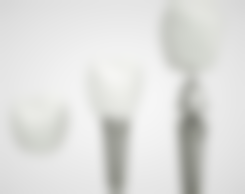 种植牙种植体松动了怎么办:分级修复方案