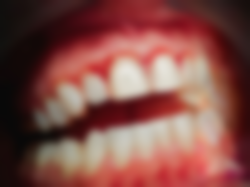 老人家种植牙好吗?——70岁+种植牙费用大揭秘