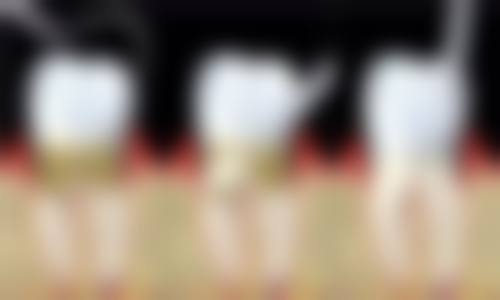 赵锐医生顾客实例成效