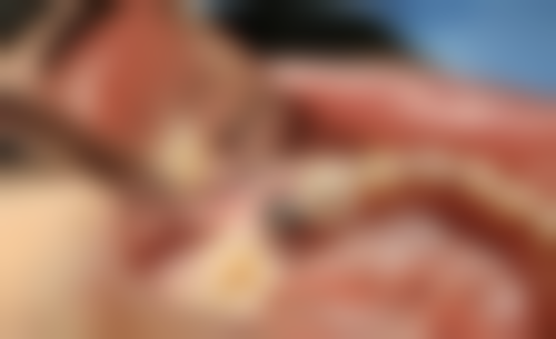 北京京大博爱口腔门诊部刘婧收费贵不贵——北京大学第三医院口腔科