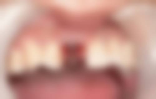 三、涟源周云口腔医院怎么样——口碑评价