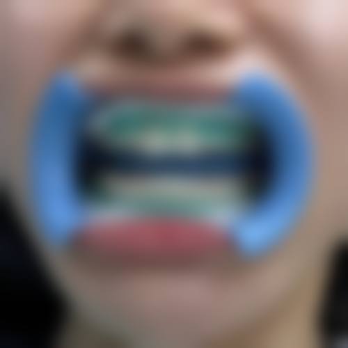 邱丽琛医生简介做手术价格