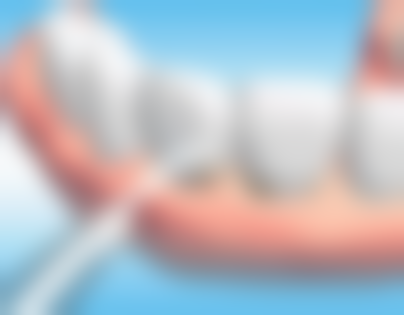 长期服药时，小心药物和种植牙“打架”